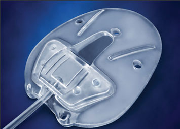 Valve