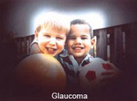 glaucoma